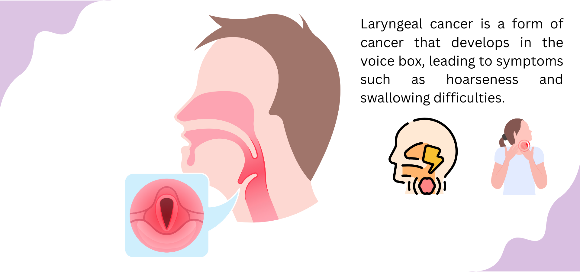Laryngeal cancer